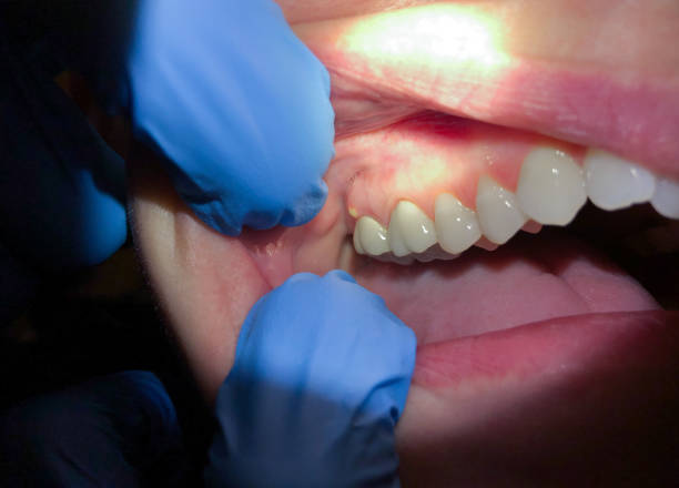 Best Emergency Dentist for Special Needs Patients in Enterprise, WV